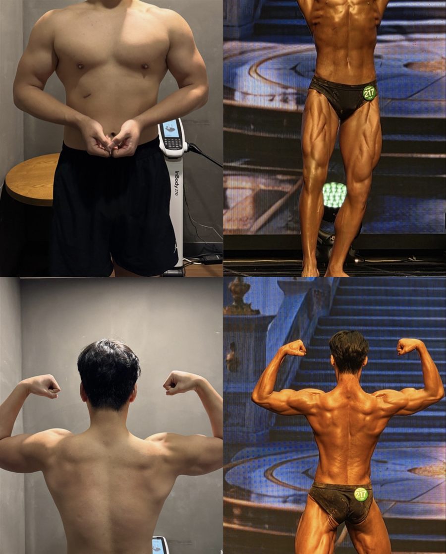 허리 무릎 통증 개선 및 대회출전 비포애프터