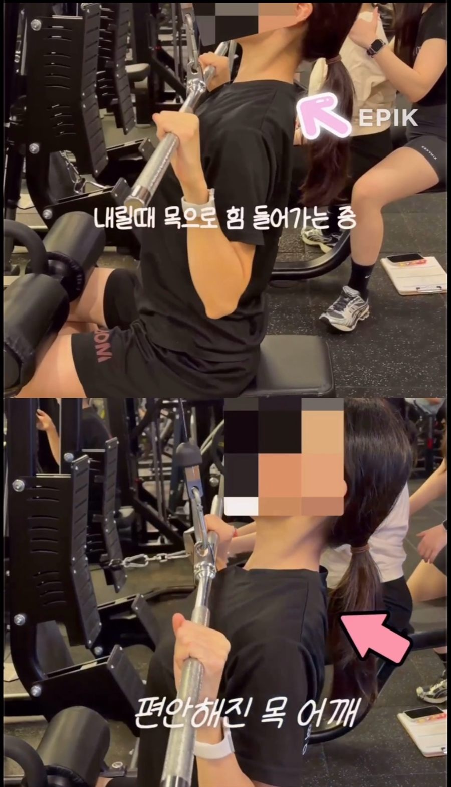 목 어깨 통증 개선 비포애프터